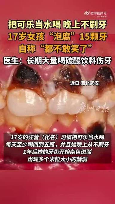碳酸饮料对牙齿的伤害__碳酸饮料溶解了什么气体