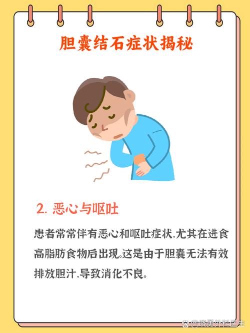 4个习惯催生胆结石！不少人4条全中，难怪肚子总不舒服~__4个习惯催生胆结石！不少人4条全中，难怪肚子总不舒服~